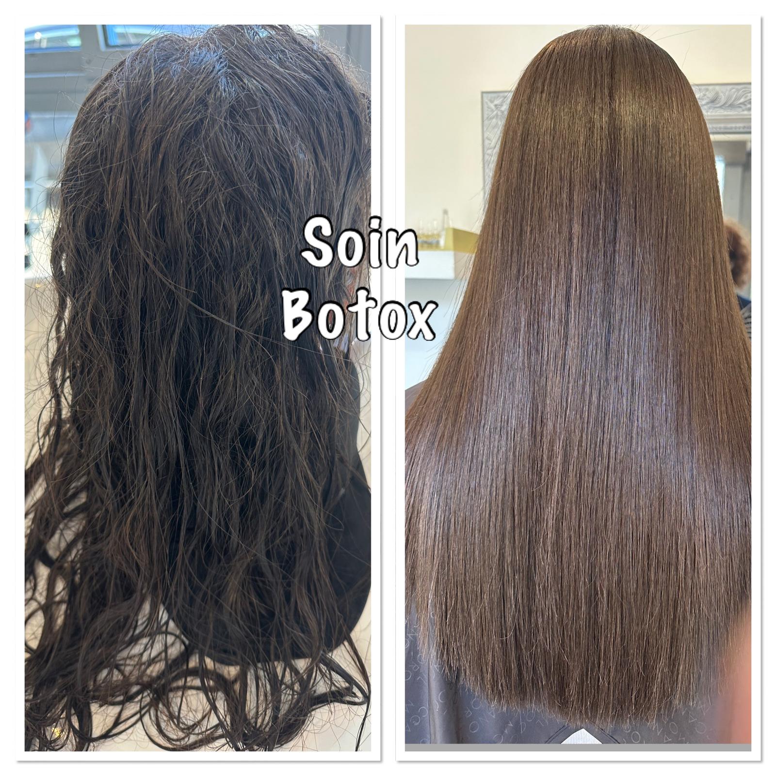 Formation soin botox